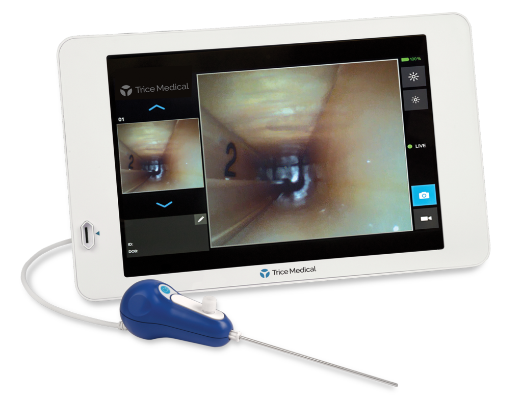 Ectr Layout seg-way endoscopic carpal tunnel release (ECTR) System - Trice Medical