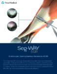 Seg-WAY EGR Sell Sheet