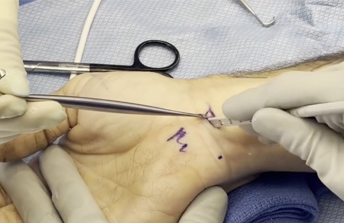 Dr. Rivlin ECTR-d Demo